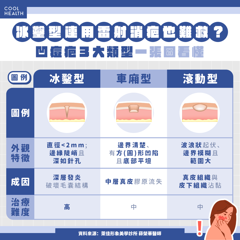 年前變美大作戰！ 新的一年直球對決「凹痘型痘疤」，醫曝1技術兼顧消疤痕、改善膚質