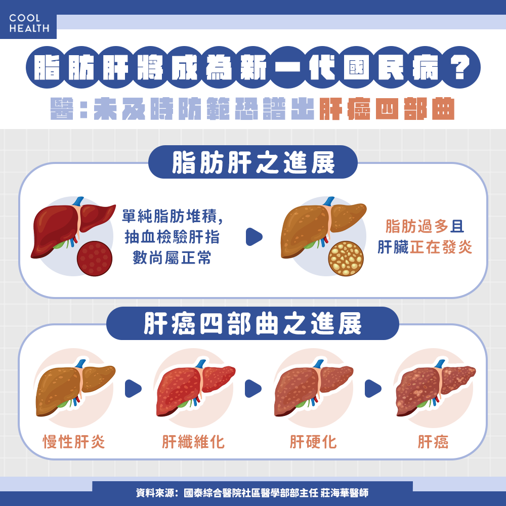 體重、BMI都正常，健檢卻驗出「脂肪肝」？醫：「泡芙人｣快做1件事改善紅字